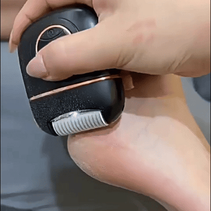 Gładkie stopy w kilka minut,koniec z twardą skórą i odciskami – automatyczny pilnik do stóp dla całej rodziny  🔥Kup 1, otrzymaj 1 gratis 🔥