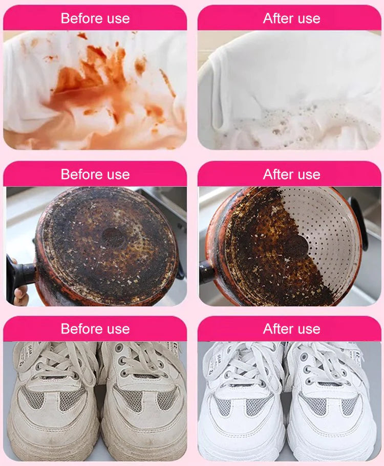 🎁【Nowo opracowany przez japońskich lekarzy】Uniwersalny środek do usuwania plam